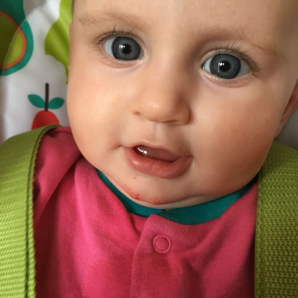 Chin Rash / Graze / Allergy?! BabyCentre